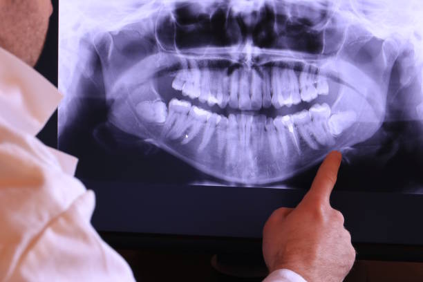 Best Emergency Dental Care for Broken or Chipped Teeth in Riley, KS