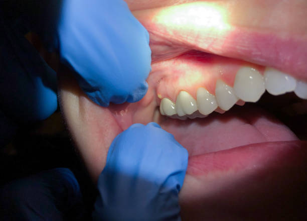 Best Emergency Denture Repair in Riley, KS